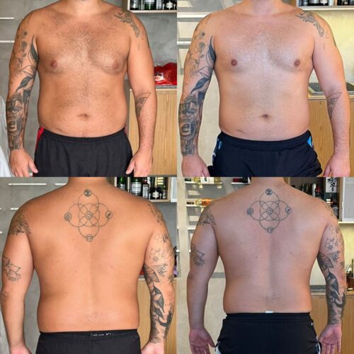 Antes e depois Gian Site